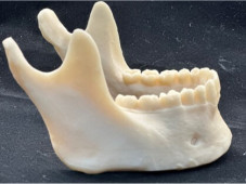 actual-teeth-1.jpg
